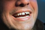 شیوه تعیین خسارت وارده بر دندان از منظر فقه و پزشکی قانونی
