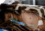 هشدار یونیسف نسبت به افزایش وبا در میان کودکان یمنی