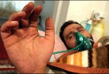 با تأکید بر قربانیان ایرانی کاربرد سلاحهای شیمیایی جنگ عراق علیه ایران