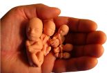 مطالعه تطبیقی امکان الزام مادر باردار به درمان در نظام حقوقی کامن لا و ایران و اسناد بین‌المللی