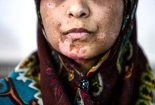 عوامل ساختاری ایجاد خشونت علیه زنان در ایران